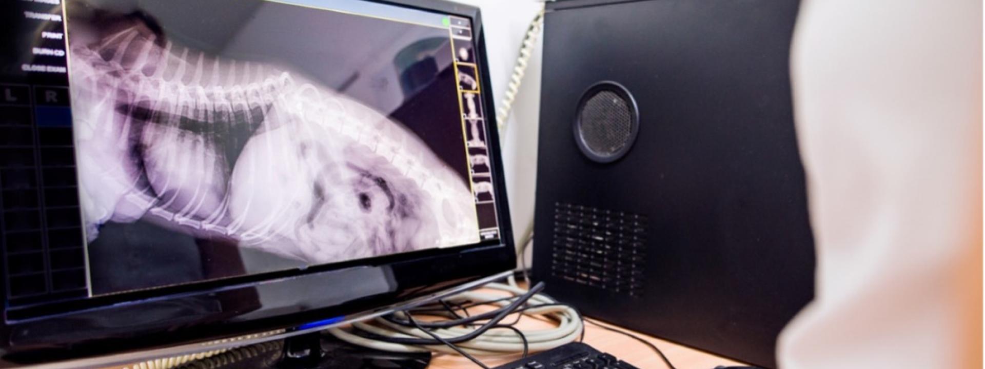 A person typing on a computer looking at x-rays